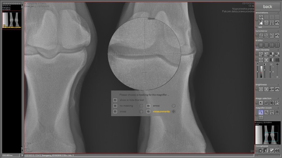 Co to jest radiografia cyfrowa?